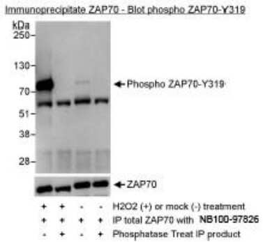 Immunoprecipitation: ZAP70 [p Tyr319] Antibody [NBP1-18896]